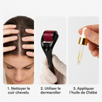Le Pack Dermaroller PRO + Huile de Chébé: Stopper la chute de vos cheveux au niveau des Tempes