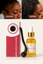 Le Pack Dermaroller PRO + Huile de Chébé: Stopper la chute de vos cheveux au niveau des Tempes
