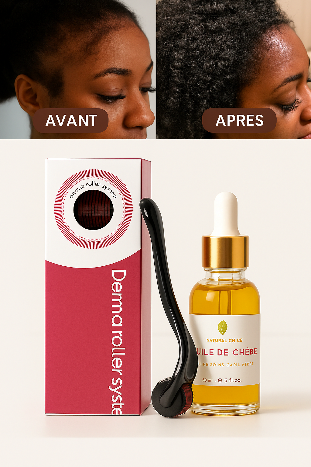 Le Pack Dermaroller PRO + Huile de Chébé: Stopper la chute de vos cheveux au niveau des Tempes