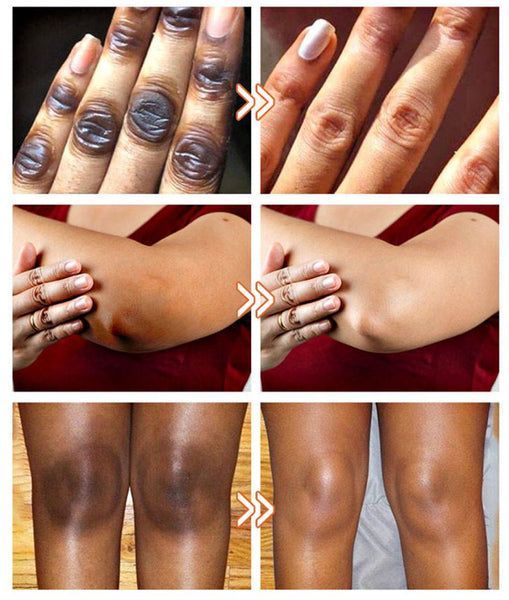 RETROUVEZ  UN TEINT UNIFORME EN QUELQUES JOURS: serum correctrice kormesic