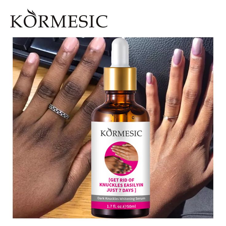 RETROUVEZ  UN TEINT UNIFORME EN QUELQUES JOURS: serum correctrice kormesic