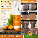 Dites enfin adieu aux boutons de rasage, aux poils incarnés et aux boutons  de la nuque