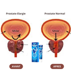 Crème Naturelle Anti-Prostate – Diminue l'inflammation, élimine les troubles urinaire,  Renforce et Redonne Confiance aux Hommes