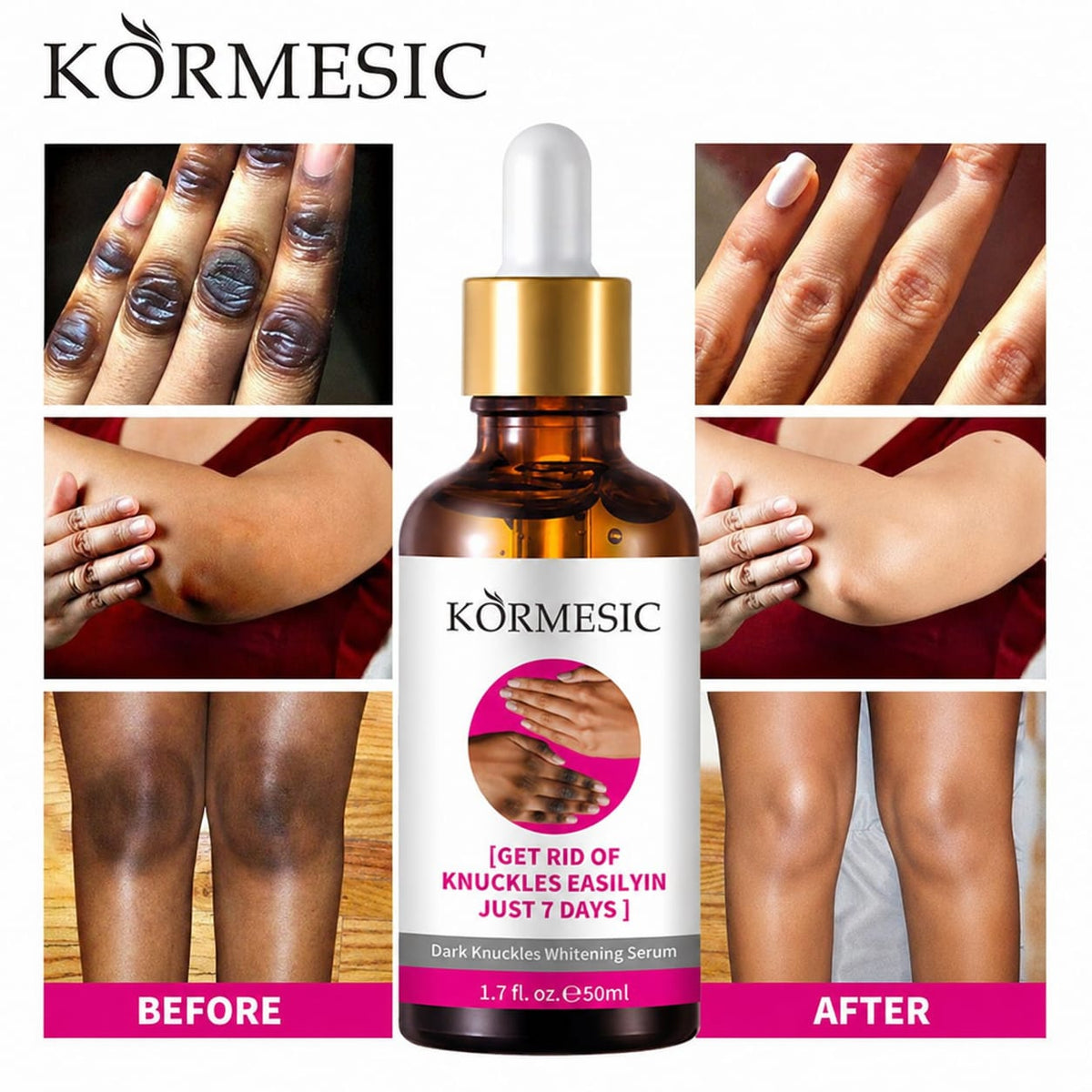 RETROUVEZ  UN TEINT UNIFORME EN QUELQUES JOURS: serum correctrice kormesic